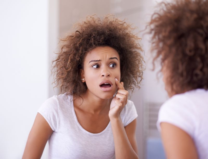Verband zuivel en acne.jpg