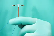 Thumbnail for article: Plaatsen van spiraal geeft ernstige tot ondraaglijke pijn bij helft van vrouwen