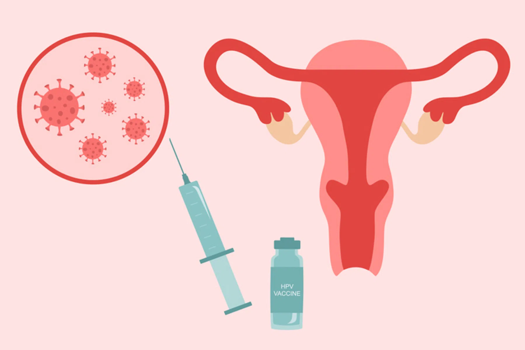 Wat zijn de symptomen van het HPV-virus bij vrouwen?
